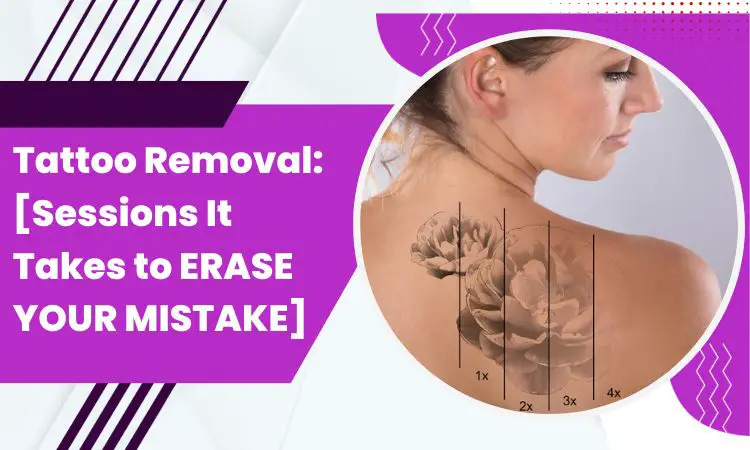 Tattoo Removal: [Sessions It Takes to ERASE YOUR MISTAKE]