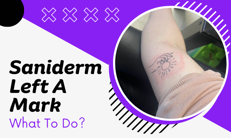 Saniderm Left A Mark- What To Do? - Tattoo Sight