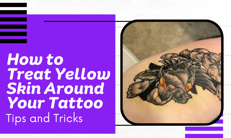yellow skin around tattoo